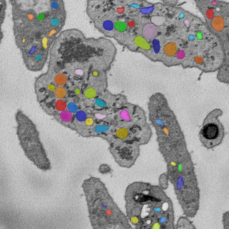 Organelle instance tags