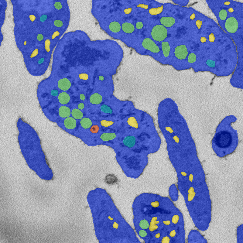 Semantic segmentation of image voxels into seven classes: Background, cytoplasm, and five organelle classes.